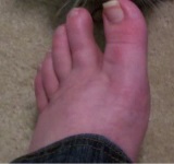 Ashley's foot.jpg