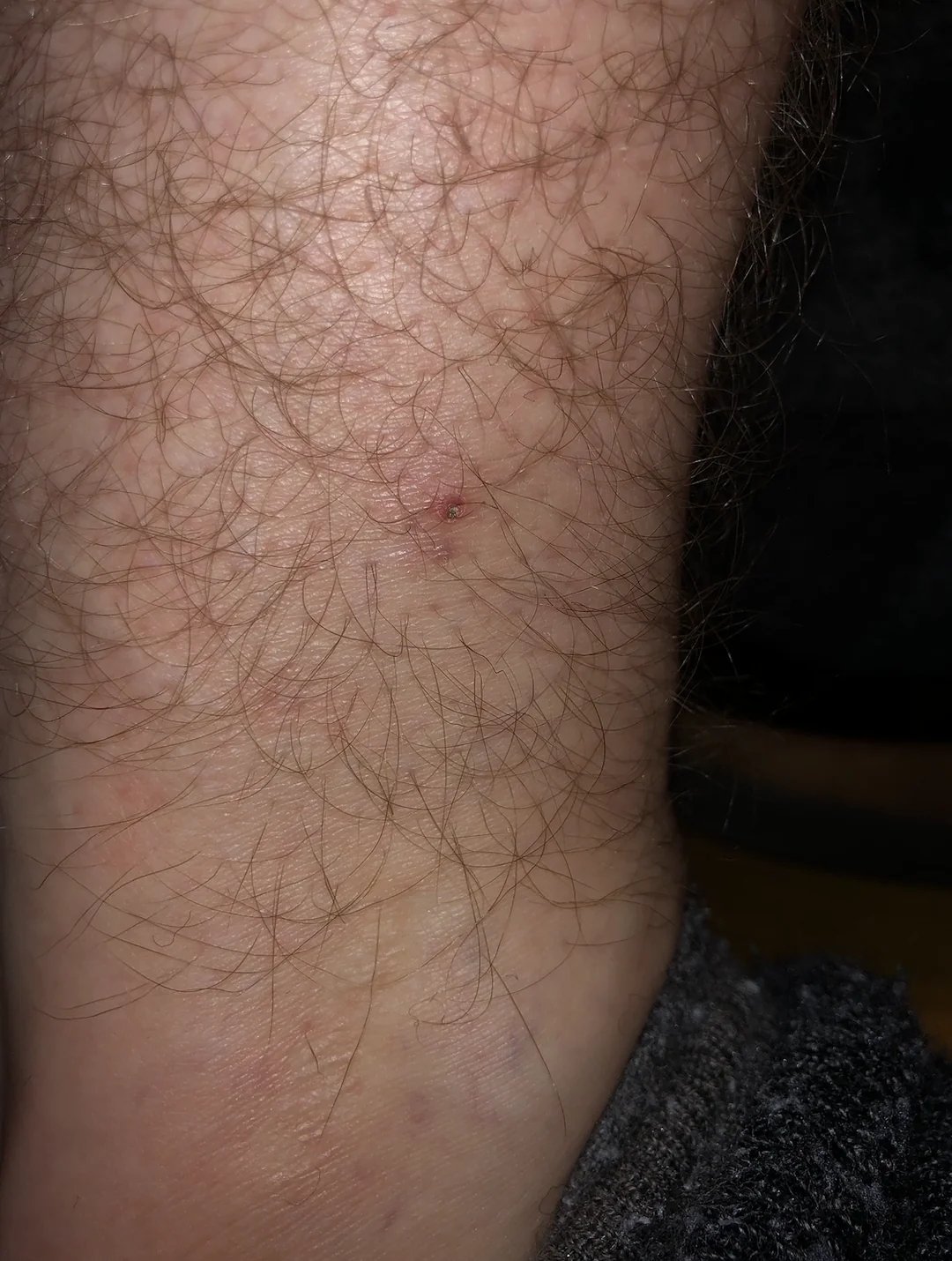 possible Josh leg 1.jpg