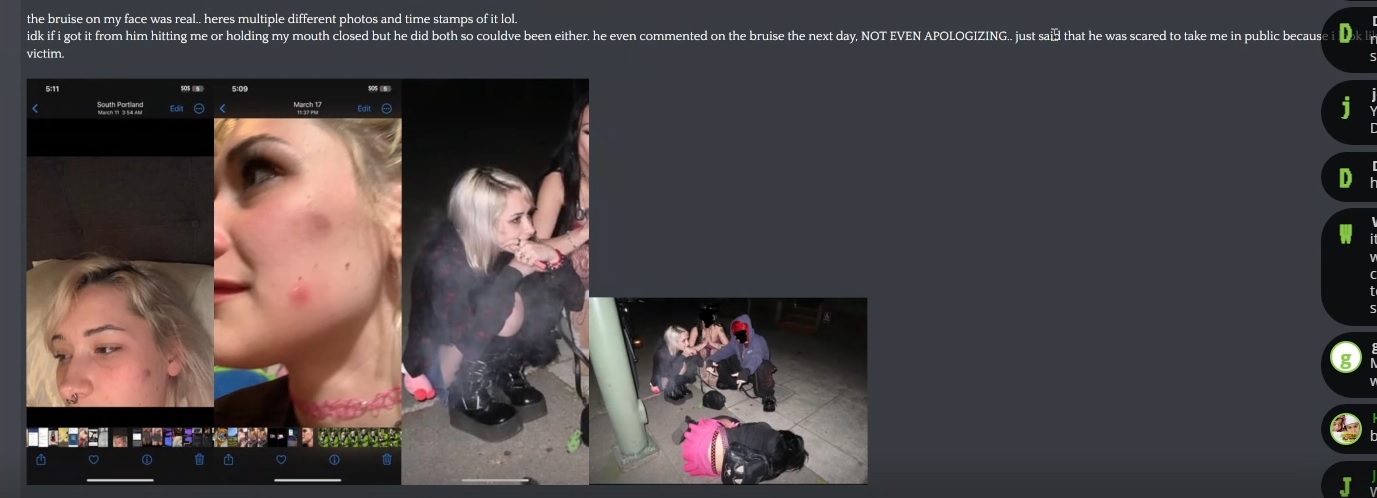 TurkeyTomTheBruiseOnMyFaceWasReal.jpg