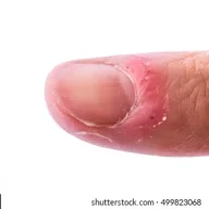 Josh Moon's Rugburned Clitty