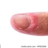 Josh Moon's Rugburned Clitty